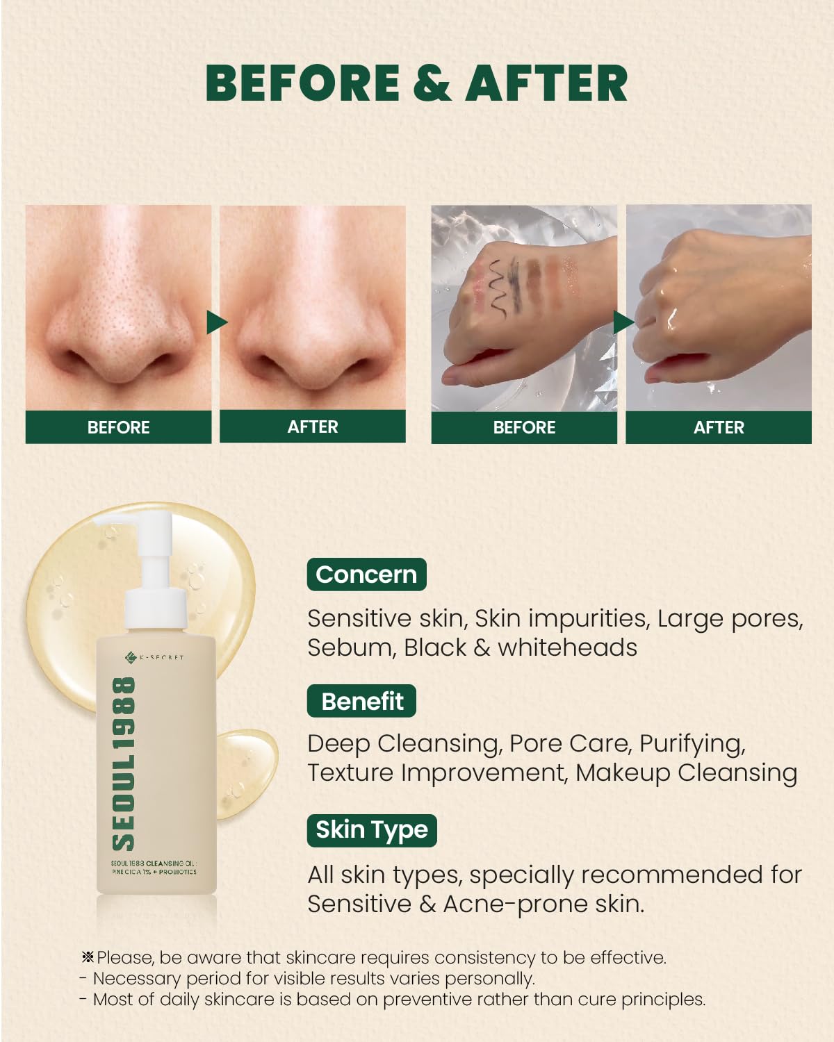 SEOUL 1988 Cleansing Oil: Pine Cica 1% + Probiotics 200ml